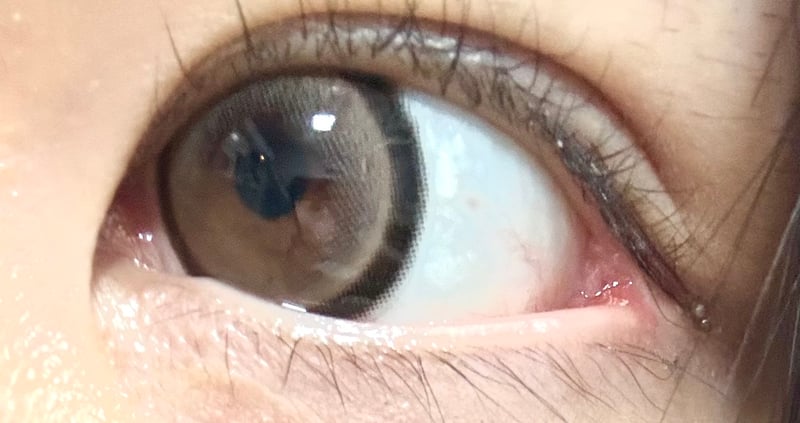 Honey Kiss 원먼스 15.0mm 츄룽캔디초코그레이(1박스 2개들이) 리뷰 사진 1